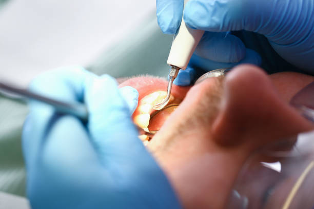 Best Emergency Care for Gum Disease in Charleroi, PA